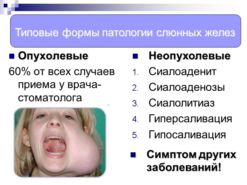 Опухолевые 60% от всех случаев приема у врача-стоматолога  Неопухолевые Сиалоаденит Сиалоаденозы Сиалолитиаз Гиперсаливация